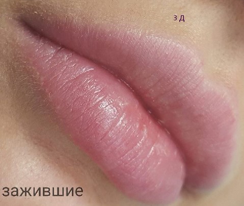 губы 3 д